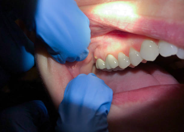 Best Emergency TMJ Treatment in Effort, PA