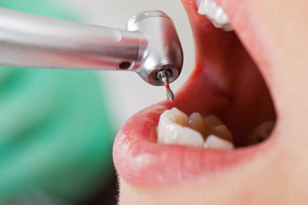 Best Same-Day Emergency Dental Services in Effort, PA